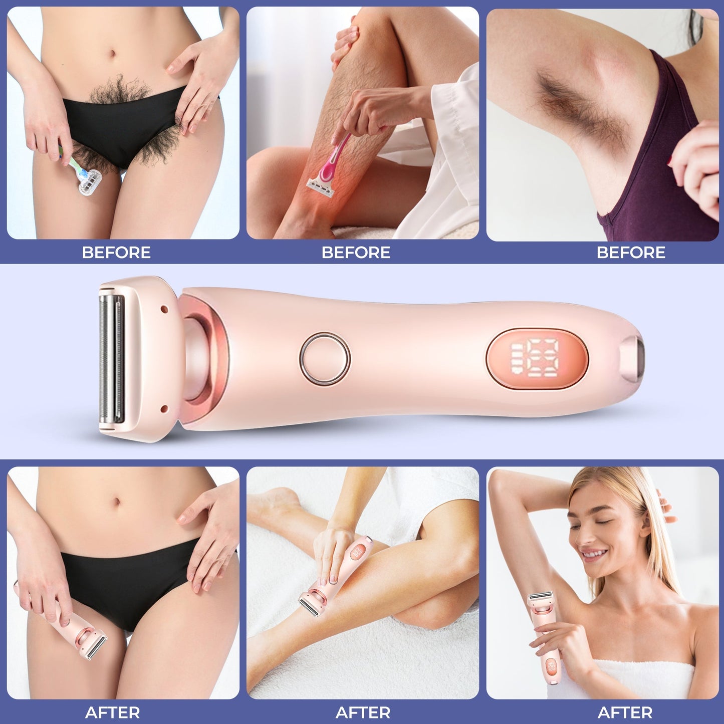 SmoothSkin - Electric Portable Razor with Dual Blades & Skin Guard 8